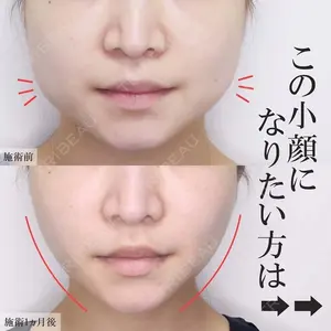 銀座TAクリニック 山田 真里江医師の症例