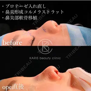 KARIS beauty clinic 滝内 ヒロフミ医師の症例