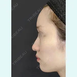 ジョウクリニック 銀座院 重本　譲医師の症例