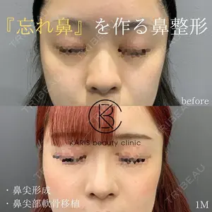 KARIS beauty clinic 滝内 ヒロフミ医師の症例