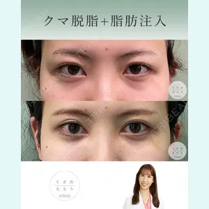 くさのたろうクリニック 立雅恵医師の症例