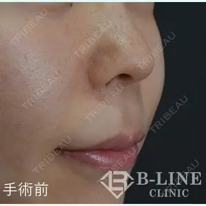 B-LINE CLINIC 池袋院 小池 康弘医師の症例