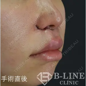 B-LINE CLINIC 池袋院 小池 康弘医師の症例