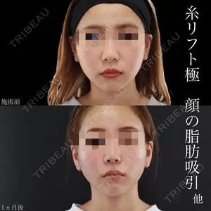 札幌TAクリニック 香山 武蔵医師の症例