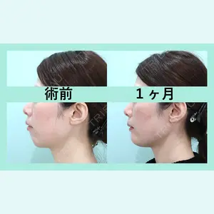 WOM CLINIC GINZA （ワム クリニック ギンザ） 佐々木 和司医師の症例