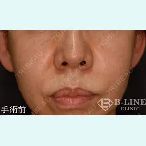 B-LINE CLINIC 池袋院 小池 康弘医師の症例