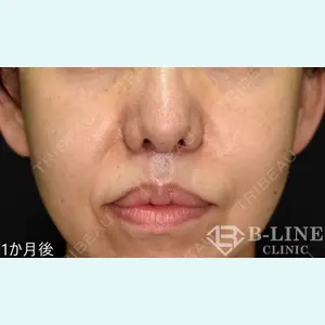 B-LINE CLINIC 池袋院 小池 康弘医師の症例