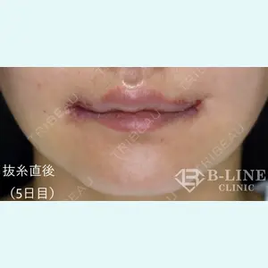 B-LINE CLINIC 池袋院 小池 康弘医師の症例