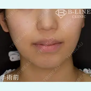 B-LINE CLINIC 池袋院 小池 康弘医師の症例