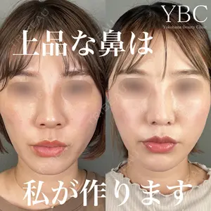 YBC横浜美容外科 大宮院 磯村 亮輔医師の症例