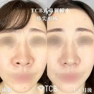 TCB東京中央美容外科 広島院 山内 崇史医師の症例