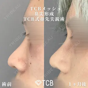 TCB東京中央美容外科 広島院 山内 崇史医師の症例