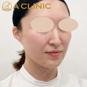 A CLINIC（エークリニック）横浜院の症例