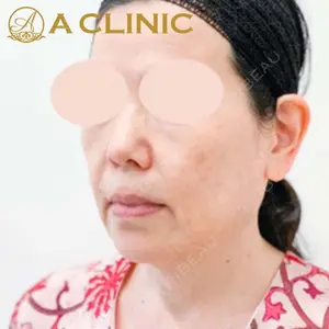 A CLINIC（エークリニック）横浜院の症例