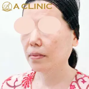 A CLINIC（エークリニック）横浜院の症例