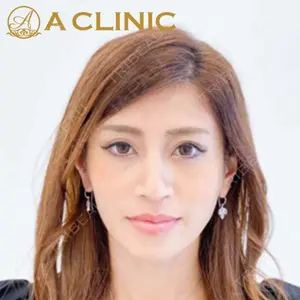 A CLINIC（エークリニック）横浜院の症例