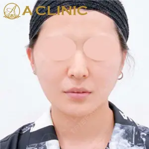 A CLINIC（エークリニック）横浜院の症例