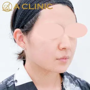 A CLINIC（エークリニック）横浜院の症例