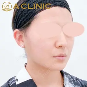 A CLINIC（エークリニック）横浜院の症例