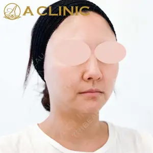 A CLINIC（エークリニック）横浜院の症例