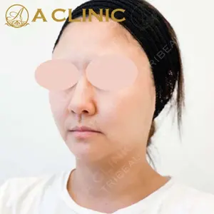 A CLINIC（エークリニック）横浜院の症例