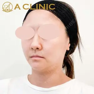 A CLINIC（エークリニック）横浜院の症例