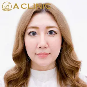 A CLINIC（エークリニック）横浜院の症例