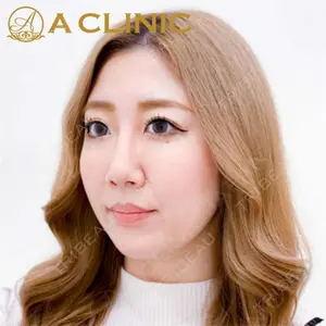 A CLINIC（エークリニック）横浜院の症例