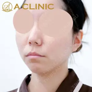 A CLINIC（エークリニック）横浜院の症例