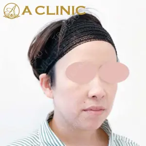 A CLINIC（エークリニック）横浜院の症例