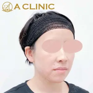 A CLINIC（エークリニック）横浜院の症例