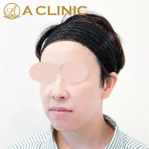 A CLINIC（エークリニック）横浜院の症例