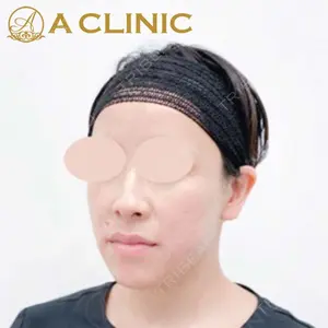 A CLINIC（エークリニック）横浜院の症例