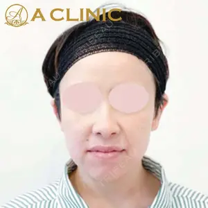 A CLINIC（エークリニック）横浜院の症例