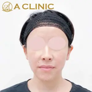 A CLINIC（エークリニック）横浜院の症例