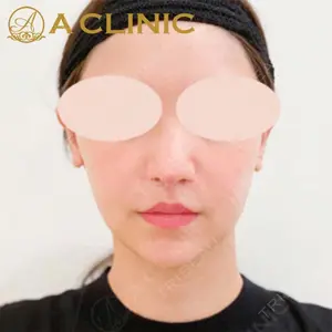 A CLINIC（エークリニック）横浜院の症例