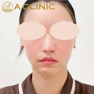 A CLINIC（エークリニック）横浜院の症例