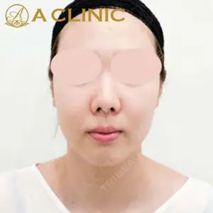 A CLINIC（エークリニック）横浜院の症例