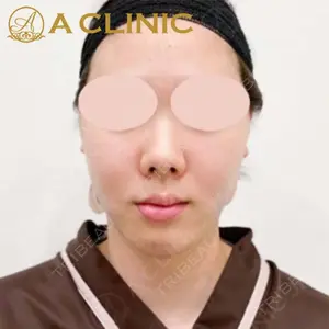 A CLINIC（エークリニック）横浜院の症例