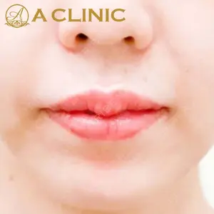 A CLINIC（エークリニック）横浜院の症例