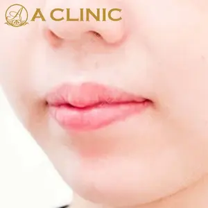 A CLINIC（エークリニック）横浜院の症例