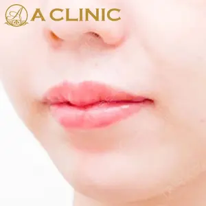 A CLINIC（エークリニック）横浜院の症例