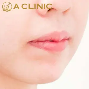 A CLINIC（エークリニック）横浜院の症例