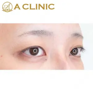 A CLINIC（エークリニック）横浜院の症例