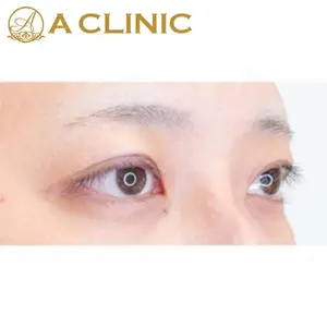 A CLINIC（エークリニック）横浜院の症例