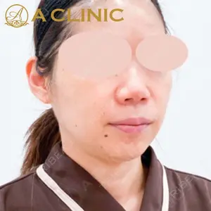 A CLINIC（エークリニック） 新宿院 片桐 大佑医師の症例