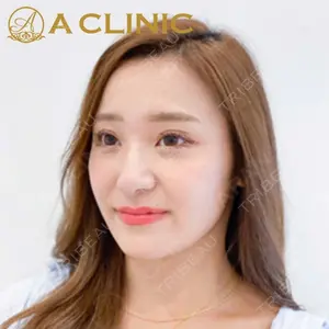 A CLINIC（エークリニック） 新宿院 片桐 大佑医師の症例