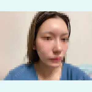 加美（GAMI）整形外科 パク・ゴヌク医師の症例