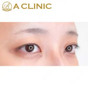 A CLINIC（エークリニック）横浜院の症例