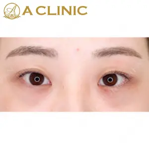 A CLINIC（エークリニック）横浜院の症例